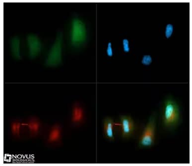 LC3B and alpha-tubulin expression in HeLa cells, ICC, Immunofluorescence, staining with Dylight 488. Dylight 550, and DAPI solution