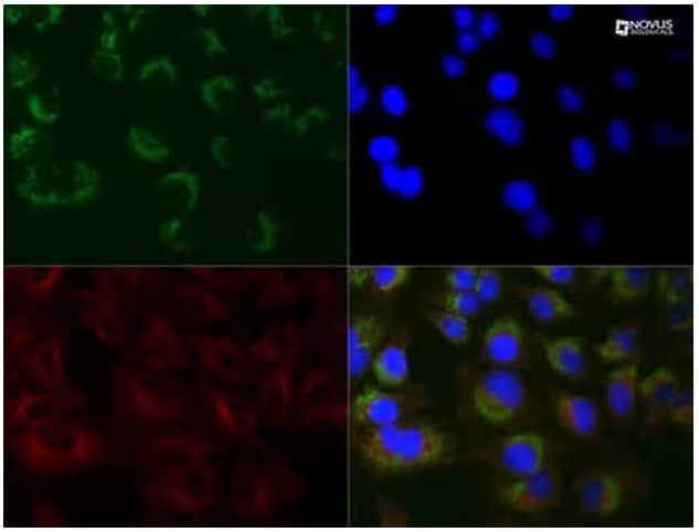 LC3B and alpha tubulin expression in Chloroquine treated HeLa cells, ICC