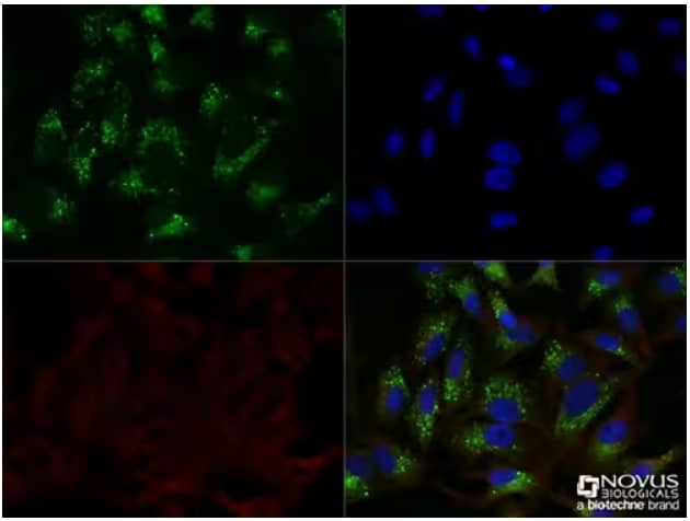 p62/SQSTM1 and alpha tubulin expression in Chloroquine treated HeLa cells, ICC