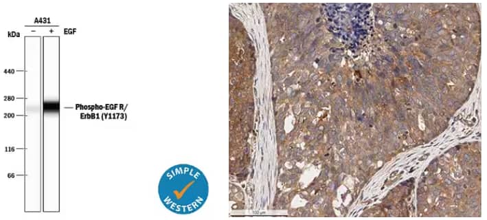 Simple Western analysis showing lysates from A431 human epithelial carcinoma cell line untreated or treated with recombinant human EGF probed with Rabbit Anti-Human Phospho-EGFR Polyclonal Antibody, showing a specific band at ~265 kDa.