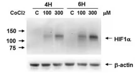 Western Blot analysis showing HIF-1 alpha expression induced in Caki-1 cell lysates treated with cobalt (II) chloride (CoCl2) at varying concentrations for 4 or 6 hours and detected by probing with Mouse Anti-HIF-1 alpha Monoclonal Antibody.