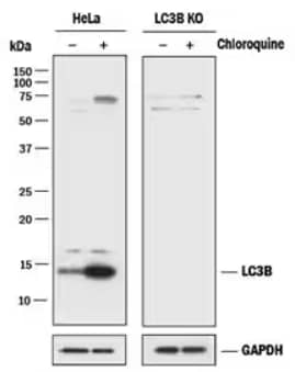 LC3B expression in HeLa human carcinoma cells, WB