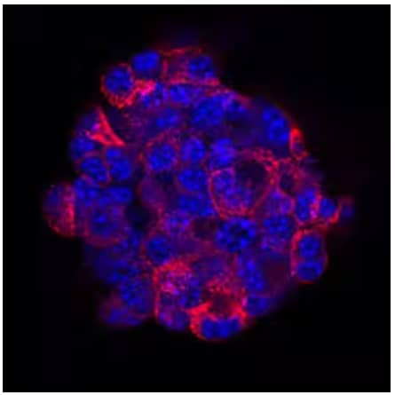 Immunocytochemical analysis showing insulin expression in immersion fixed TC-6 mouse beta cell insulinoma cell line using Anti-Insulin Monoclonal Antibody and stained with NorthernLights 557-conjugated IgG Secondary Antibody.