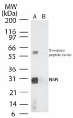 aWestern blot analysis for smallpox virus B5R in smallpox virus fusion protein containing amino acids 180-194 (lane A) versus fusion protein without (lane B) using Rabbit Anti-Smallpox B5R Polyclonal Antibody detecting a band in lane A but not lane B.