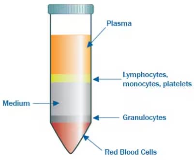 Isolation of immune cells from whole blood cells is possible by the use of a density gradient medium upon which whole blood cell is layered. Following centrifugation, different whole blood cell components settle in different layers based on their inherent