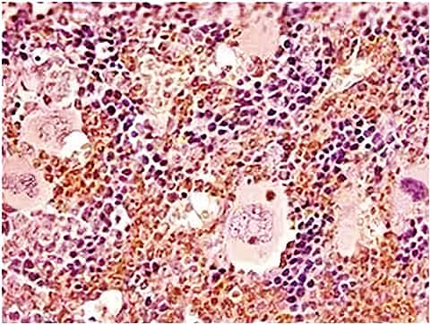 Ly-6G expression in mouse bone marrow FFPE tissue section IHC