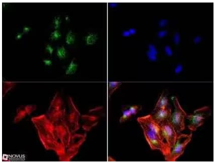 Immunocytochemistry/Immunofluorescence: Mannose 6 Phosphate Receptor (Cation independent) Antibody