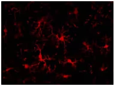 mapk-signaling-links-autophagy-and-inflammation-fig-2