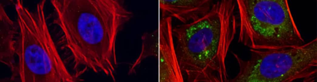 Expression of p62/SQSTM1 in HeLa cells mock- or chloroquine-treated, ICC