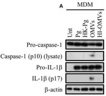 Western blot of lysates from monocyte-derived macrophages (MDMs) either untreated or infected with P. gingivalis (Pg), Heat-Inactivated Pg (HI-Pg), outer membrane vesicles (OMVs), or HI-OMVs, and probed from inflammasome components using anti-caspase-1 an