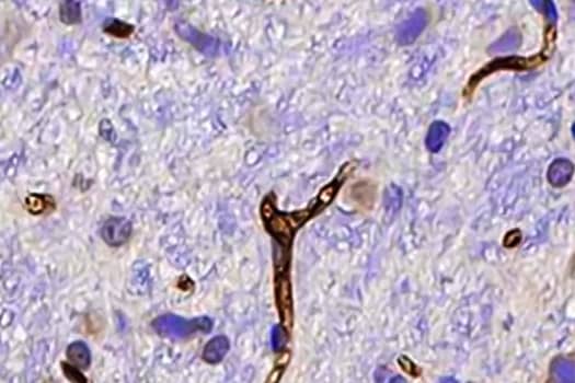 Immunohistochemical analysis of MHC Class I expression in rat brain cerebellum tissue shown with DAB staining (brown) and counterstaining with hematoxylin (blue).