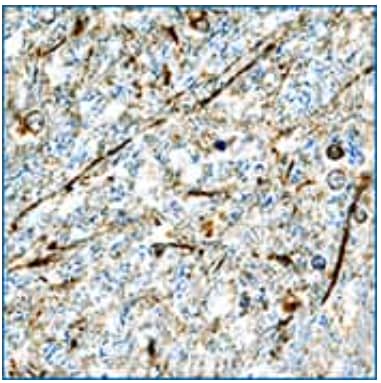 alpha -Synuclein expression in human brain hypothalamus, IHC