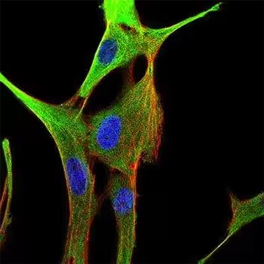 Alpha-tubulin expression (green) and actin filaments (red) in C6 cells with nuclei stained with DAPI (blue), ICC/IF.