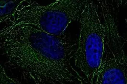 Alpha tubilin expression (green) in fixed and permeabilize HeLa cells and nuclei counterstained with DAPI (blue).