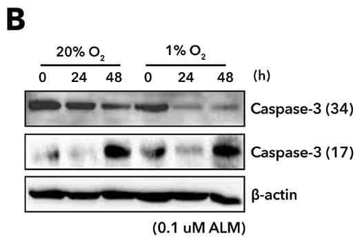 Immunocytochemical detection of caspase-3 in immersion fixed Jurkat human acute T cell leukemia cell lines treated with Staurosprine alongside untreated control cells and probed with anti-caspase-3 antibody and detected with NL557-conjugated secondary ant