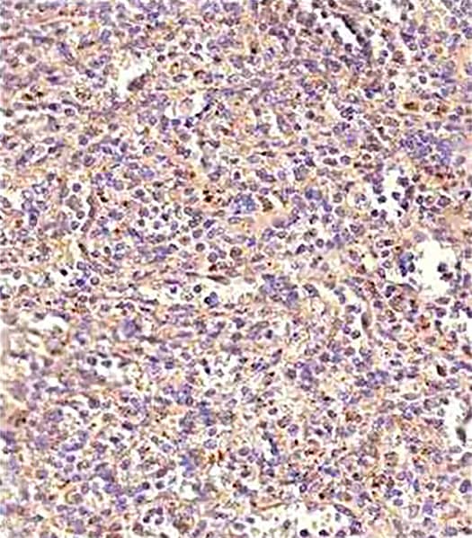 CD68 expression in human spleen macrophages, IHC