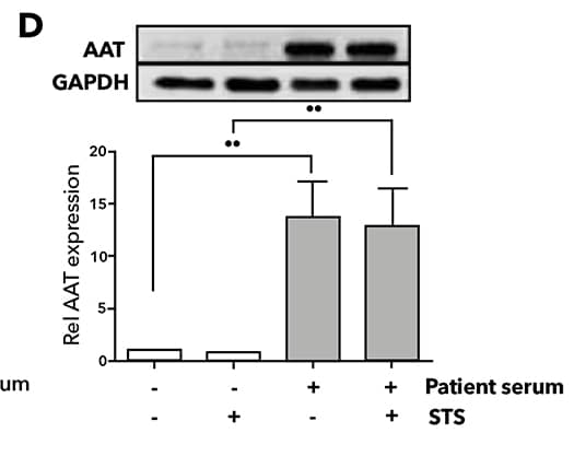 AAT protein expression in neutrophils analyzed by Western Blot relative to GAPDH loading control.