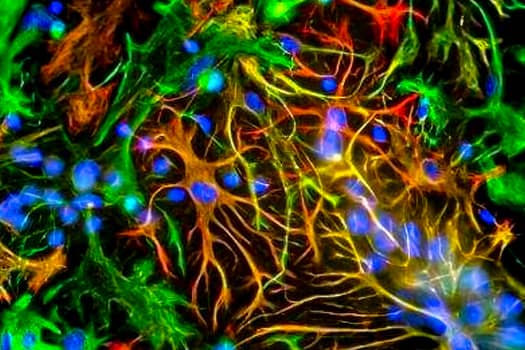 Immuncytochemical analysis of GFAP (red) and Vimentin (green) expression in mixed neuron-glial cultures.