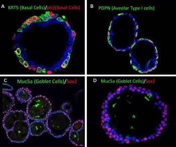 Human lung organoids stained with antibodies to show lung cell marker expression.