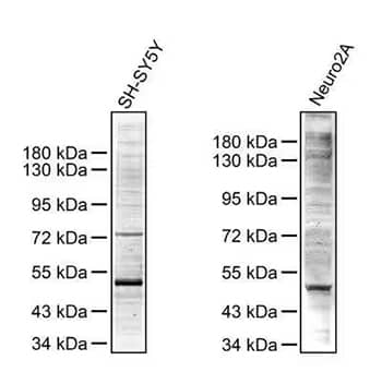 Western blot analysis showing phosphoserine expression in SH-SY5Y (left) and Neuro2A (right) whole cell lysates.