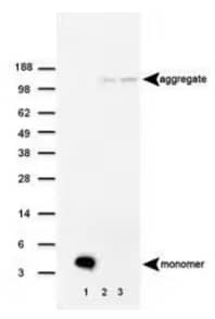 beta amyloid expression in mouse brain homogenate, Western blot