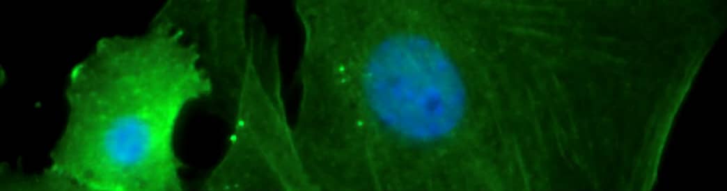 Immunostaining of NIH-3T3 cells in culture with a mouse monoclonal actin antibody, green fluorescence was visualized at 40X.