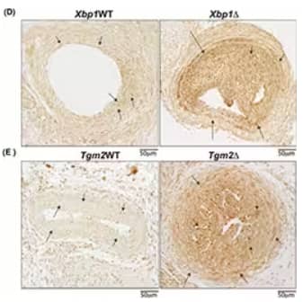 Immunohistochemical analysis of IRE1 alpha expression in neointima in situ carotid artery tissue sections of Xbp1 and Tgm2 wildtype and deficient mice using Rabbit anti-IRE1 alpha Polyclonal Antibody showing increased expression in deficient mice.