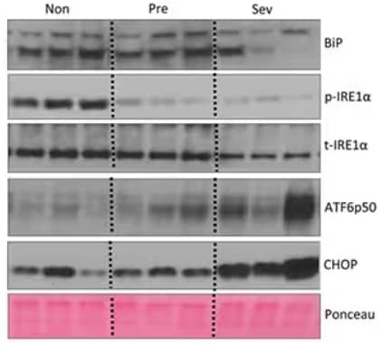 Western blot analysis showing lysates from liver of non, pre- and severely cachectic mice probed for ER stress markers including BiP, phospho-IRE1a, total-IRE1a, ATF6p50, and CHOP, using Rabbit anti-IRE1 alpha Polyclonal Antibody for p-IRE1a expression.