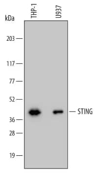 STING antibody