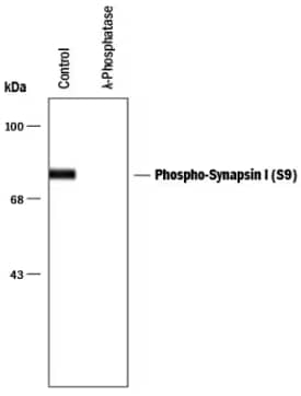 Synapsin I antibody PPS084