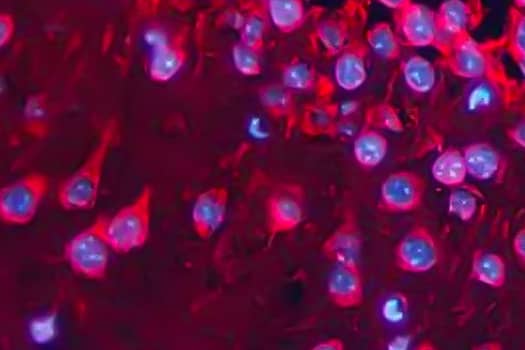 Synaptophysin expression in mouse brain hippocampus, IHC