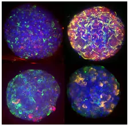 The Tissue Clearing Pro-Organoid Kit used on liver spheroids to stain for the visualization of multiple structures including DNA, MRPII, and MDRI (upper left); DNA, CD68, Albumin, and Vimentin (upper right); DNA, panCK, and CD31 (lower left); and DNA, pan