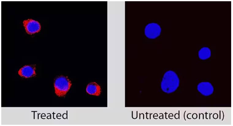 Immunocytochemical detection of caspase-3 in immersion fixed Jurkat human acute T cell leukemia cell lines treated with Staurosprine alongside untreated control cells and probed with anti-caspase-3 antibody and detected with NL557-conjugated secondary ant