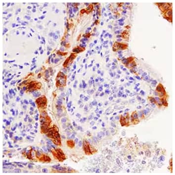 HAl-1 antibody