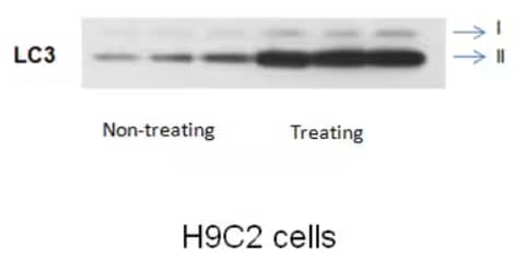 LC3I and LC3II expression in treated and non-treated H9C2 cells, WB