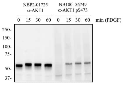 AKT1 protein analysis in 3T3 cells treated and untreated with PDGF for 0 to 60 minutes: AKT1 and AKT1pSer473 were detected in cell lysates by Western blot.