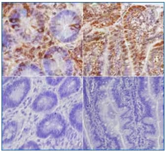 TLR5 expression in human intestine, IHC