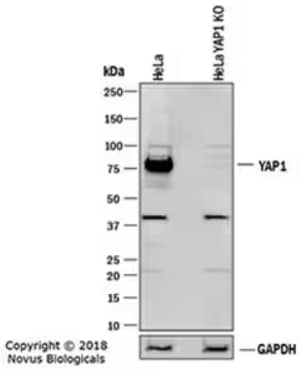 Knockout (KO) validated Western blot showing HeLa parental cell line and YAP1 KO HeLa cell line probed with rabbit polyclonal YAP1 antibody and followed by HRP-conjugated secondary antibody, with results indicating a specific band for YAP1 in the parental