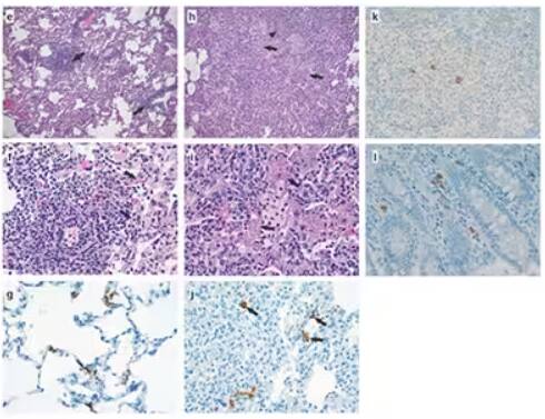 SARS-CoV nucleocapsid antibody, Novus Biologicals.