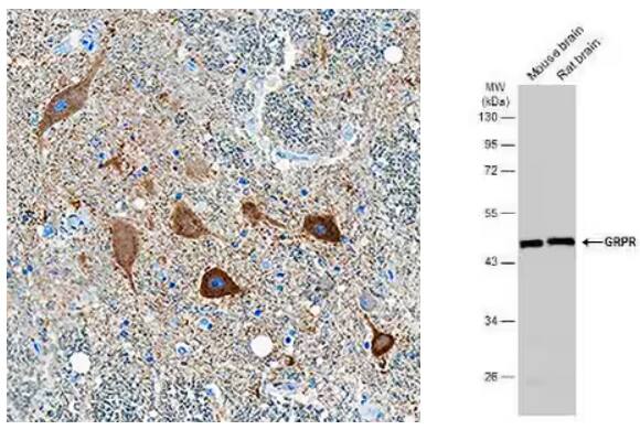 Immunohistochemical staining of spinal cord tissue probed with anti-Ret polyclonal antibody and then VisUCyte HRP Polymer antibody, followed by DAB staining and counterstaining with hematoxylin, with specific staining localized to motor neurons.