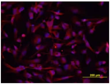 Immunocytochemical staining of A172 human glioblastoma cell line with anti-DSCAM Polyclonal antibody, followed by NorthernLights-557 Secondary Antibody.