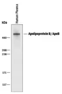 Western blot for ApoB100