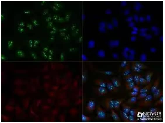 ICC/IF detection of DDX21 in hela cells