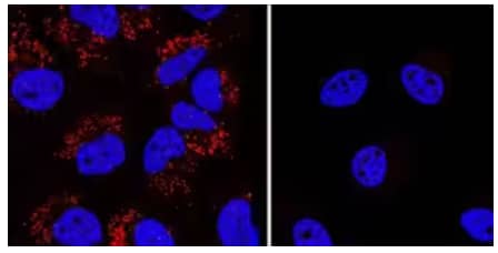 Immunocytochemical analysis showing LC3B expression in Chloroquine-treated HeLa cells, but not in LC3B-Knockout (KO) HeLa cells, using Anti-LC3B Polyclonal Antibody and stained with NorthernLights 557-conjugated IgG Secondary Antibody.