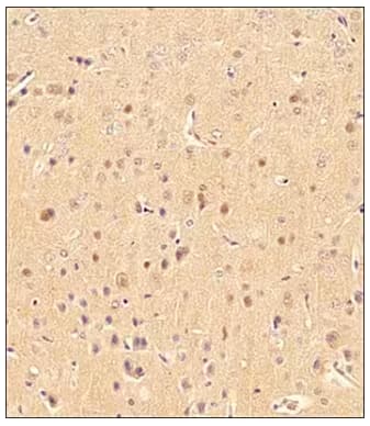 Immunohistochemical analysis of LC3B expression in formalin-fixed paraffin-embedded human brain tissue sections