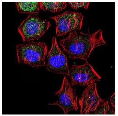 Confocal analysis of immunocytochemical staining showing LC3B, actin filament, and nuclear expression in HeLa cells.