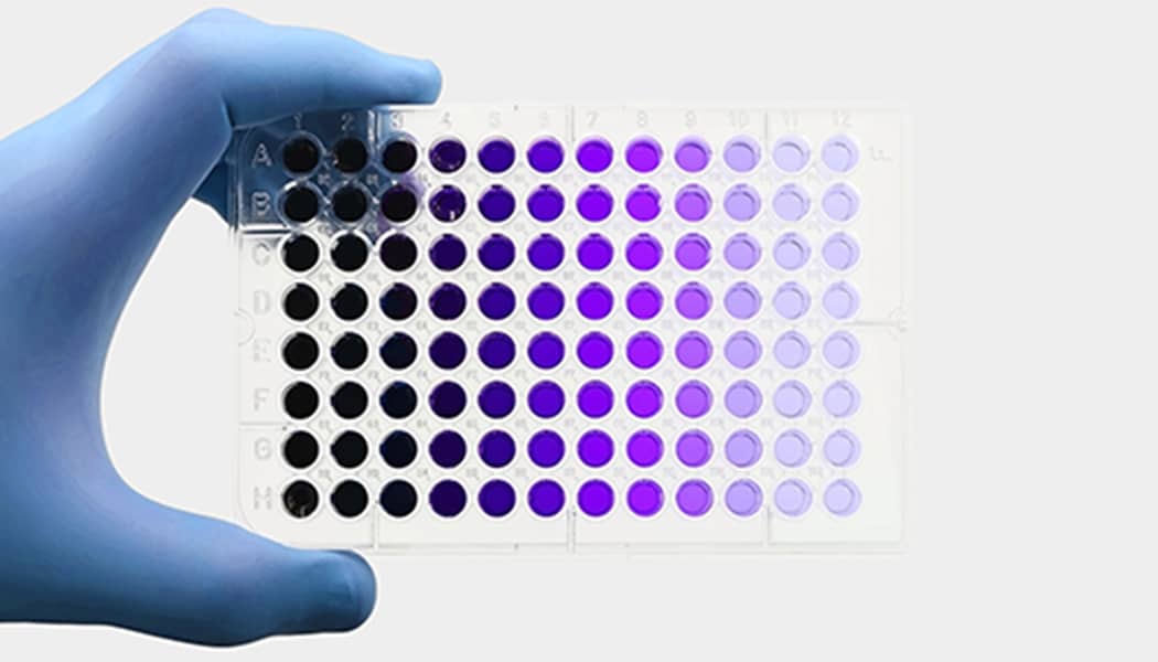 Molecular Diagnostic Kits