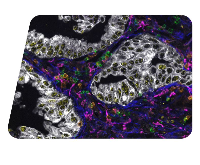Learn about advancing translational research with Bio-Techne Spatial at the Biomarkers, CDx & Precision Medicine conference FrontImg