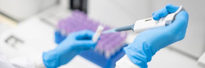 IVD Immunoassay Development Solutions Teaser BG