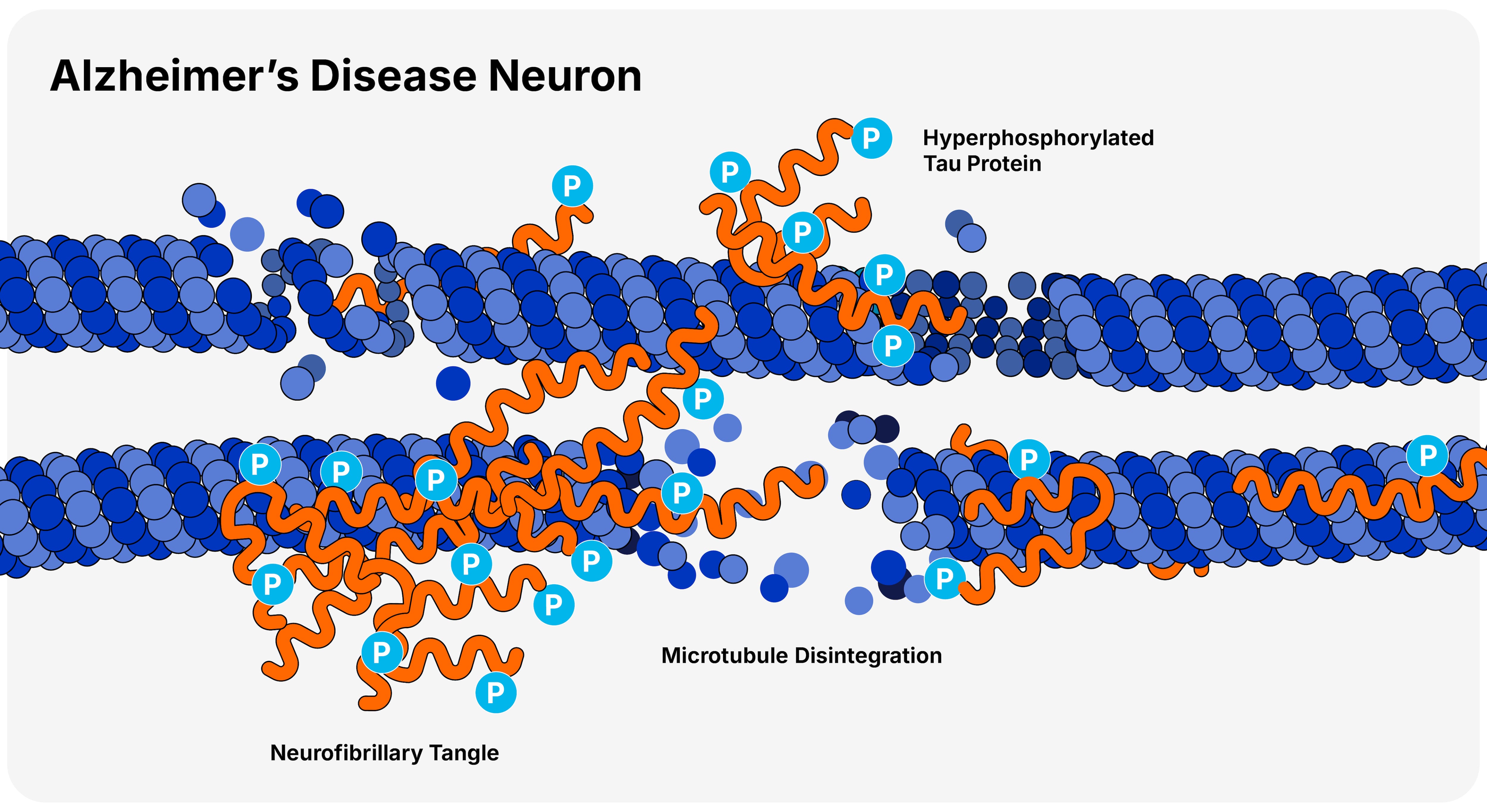 pTau Illustration - alzheimer's disease neuron